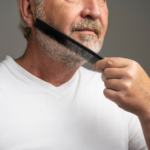 What to Know Before Getting a Beard Hair Loss Treatment