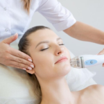 How Ultraformer III Compares to Traditional Skin Tightening