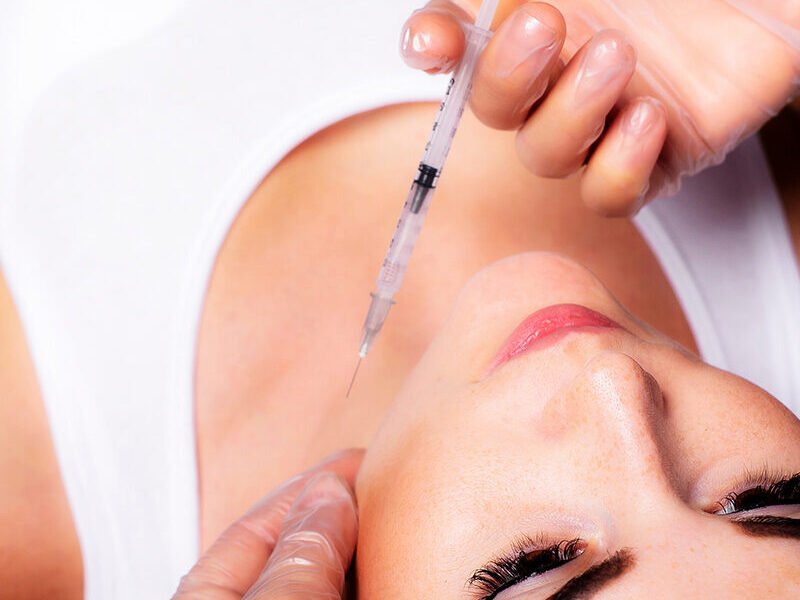 Smoothness with Radiesse Filler