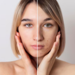 How Skin Care Creams Help with Dark Spot Treatment