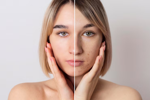 Dark Spot Treatment
