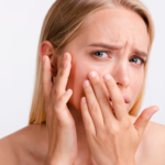 What Skin Concerns Can Be Treated with Ultherapy