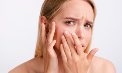 Treated with Ultherapy