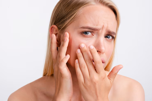 Treated with Ultherapy