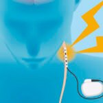 5 Ways Therapy Can Transform the Healing Process