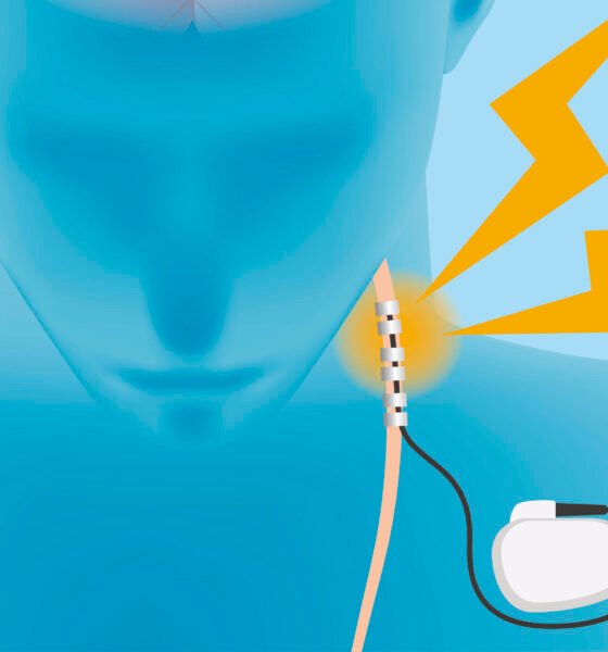 s Therapy Can Transform the Healing Process