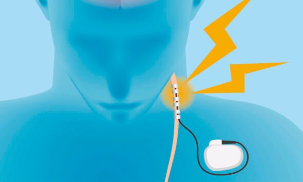 s Therapy Can Transform the Healing Process