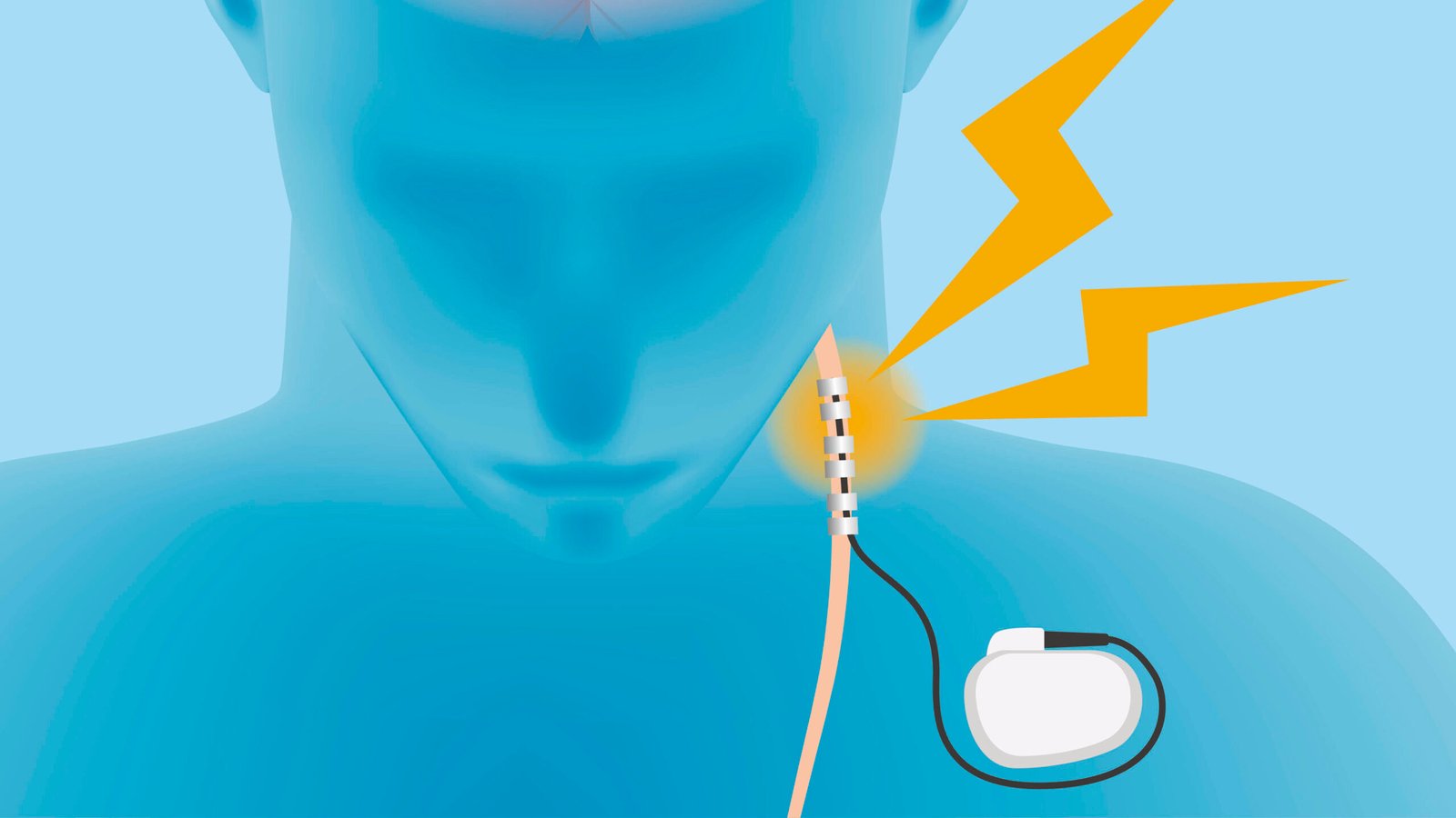 s Therapy Can Transform the Healing Process