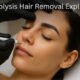 Electrolysis Hair Removal
